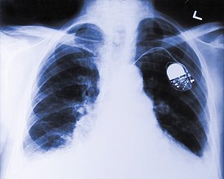 99热这只有：热度登顶，极速王者的终极馈赠-2