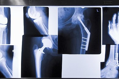 性别管自由凸轮的背景和历史发展:蒸汽齿轮中的身份革命,近未来都市的自由调律之旅-1