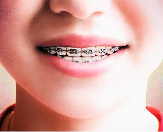 男人把香蕉扦插女人桃子:果核竞速,嫁接未来,赛道绽放融合之花-1